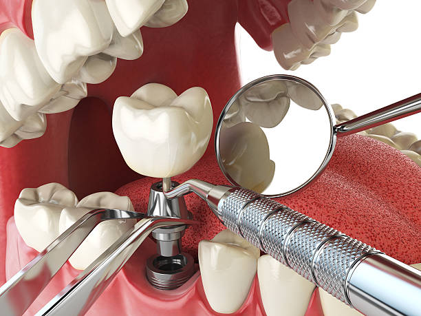  Panthersville, GA Emergency Dentist Pros