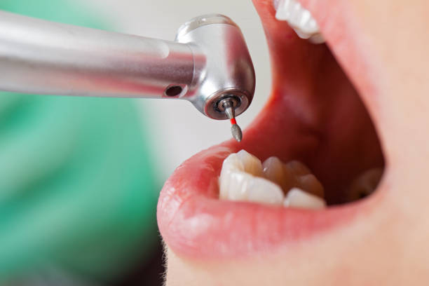 Best Emergency Dental Surgery in Panthersville, GA